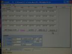 Fscan II therapy screen (software) ... (Click to enlarge)