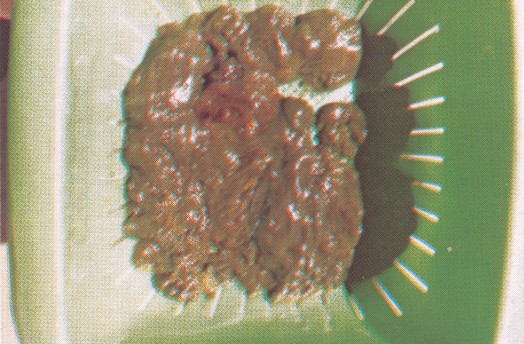 Image: Mucoid Plaque. Photo from Dr. Jensen's Bowel Management Book Image: Mucoid Plaque. Photo from Dr. Jensen's Bowel Management Book