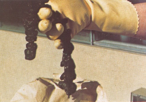Image: Mucoid Plaque. Photo from Dr. Jensen's Bowel Management Book Image: Mucoid Plaque. Photo from Dr. Jensen's Bowel Management Book