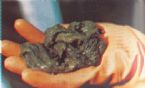 Mucoid Plaque. Photo from Dr. Jensen's  Bowel Management Book ... (Click to enlarge)
