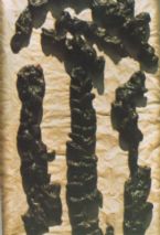 Mucoid Plaque. Photo from Dr. Jensen's  Bowel Management Book ... (Click to enlarge)