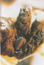 Mucoid Plaque. Photo from Dr. Jensen's  Bowel Management Book ... (Click to enlarge)