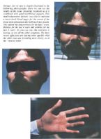 Skin Healing, Psoriasis Gangrene, Dr. Jensen's  Bowel Management Book ... (Click to enlarge)