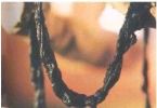 Mucoid Plaque. Photo from Dr. Bernard Jensen's  Bowel Management Book ... (Click to enlarge)