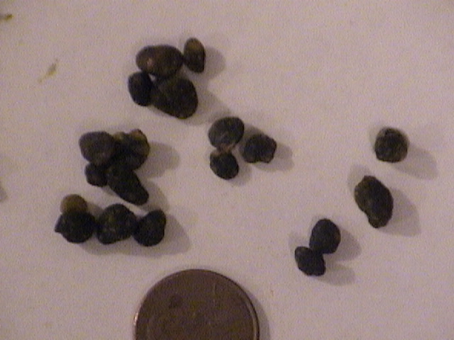 Image:  Liver Flush Results