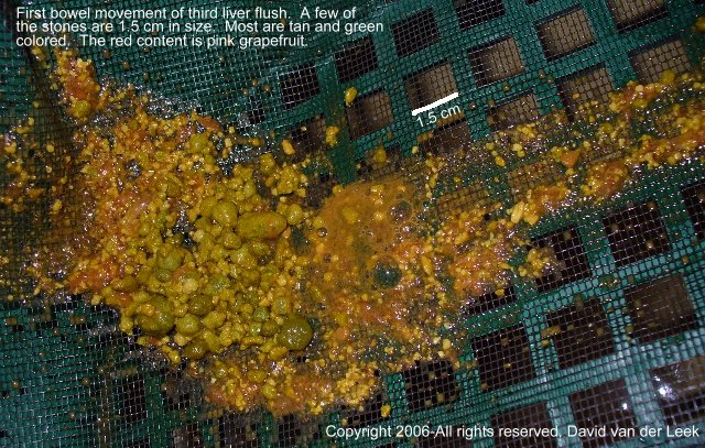 Image: 3rd Liver Flush Image: 3rd Liver Flush