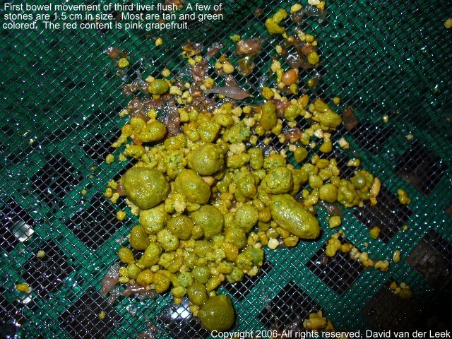 Image: 3rd Liver Flush Image: 3rd Liver Flush