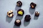 gallstones from the gallbladder ... (Click to enlarge)