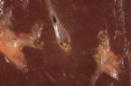 Liver with Intrahepatic Stone ... (Click to enlarge)