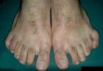203 sixtoes ... (Click to enlarge)