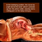 supine ... (Click to enlarge)
