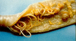 ascaris_lumbricoides ascaris_lumbricoides