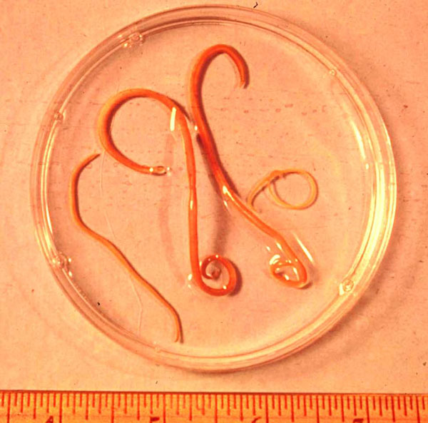 parasites/ascaris_lumbricoides parasites/ascaris_lumbricoides