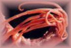 Acaris lumbricoides round worm ... (Click to enlarge)