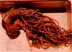 parasites/ascaris_lumbricoides ... (Click to enlarge)