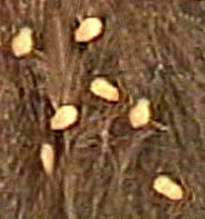 tapeworms seg 20crop tapeworms seg 20crop