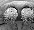 Head_tapeworm.jpg ... (Click to enlarge)
