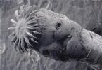 Scolex: Tapeworm head ... (Click to enlarge)