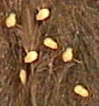tapeworms seg 20crop ... (Click to enlarge)
